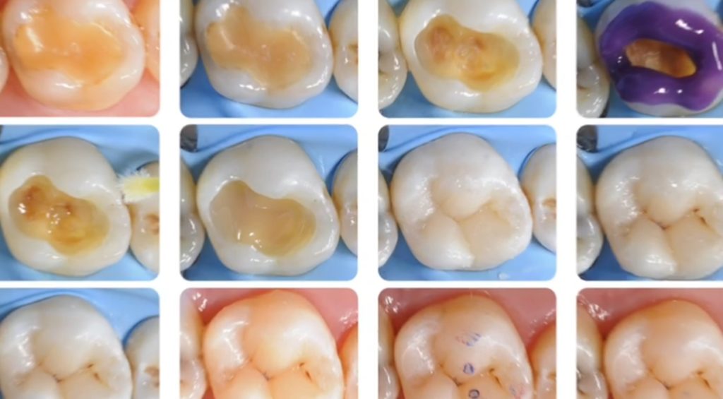 News e approfondimenti | Studio Dentistico Ragucci